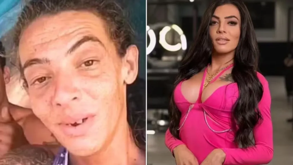 Influenciadora que viveu nas ruas faz 10ª cirurgia e impressiona Influenciadora que viveu nas ruas faz 10ª cirurgia e impressiona