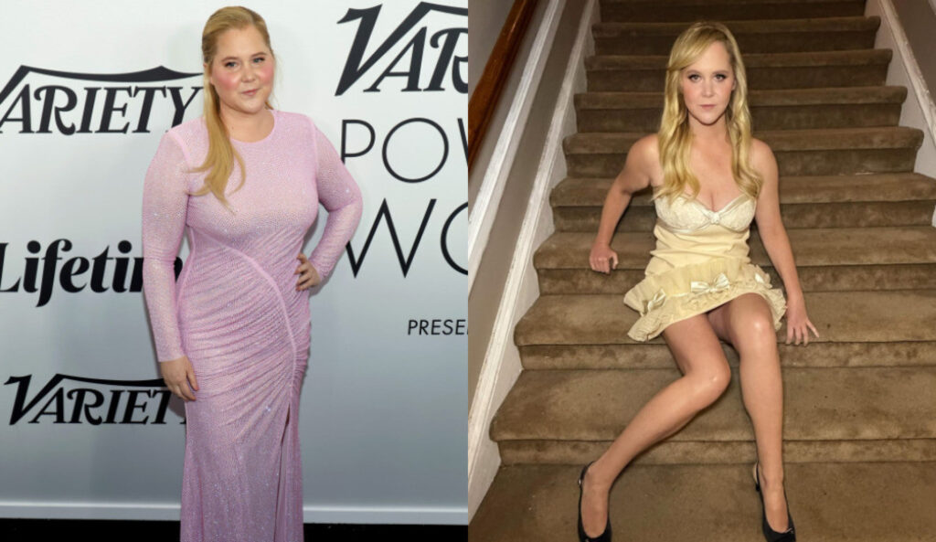 Amy Schumer perde 23 quilos e impressiona: “Fiz isto para sobreviver” Notícias ao Minuto