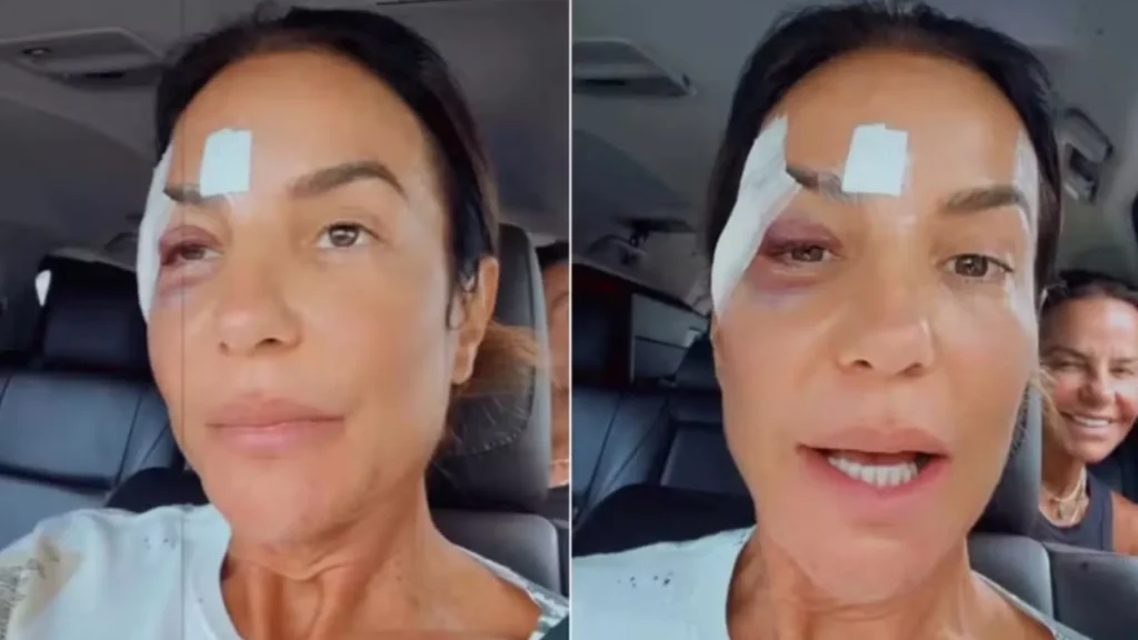 Ivete Sangalo passa por cirurgia neste domingo, diz portal Ivete Sangalo passa por cirurgia neste domingo, diz portal